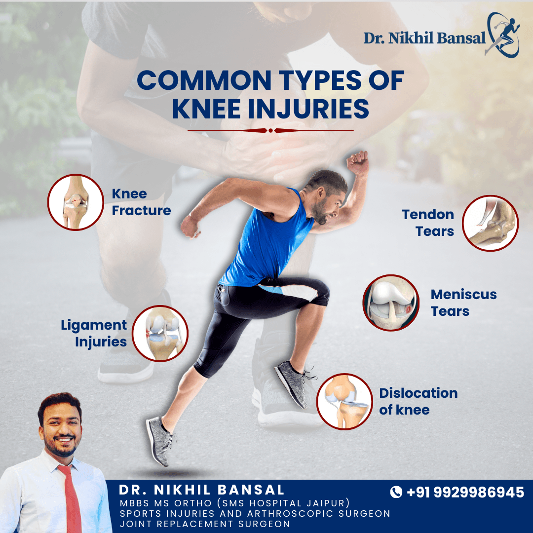 common type of knee injury1